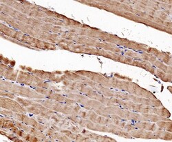 Invitrogen CaV1.1 Polyclonal Antibody 100 &mu;g | Buy Online | Invitrogen&trade; | Fisher Scientific