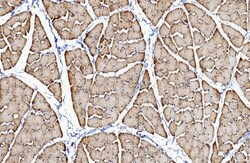 Invitrogen CaV1.1 Polyclonal Antibody 100 &mu;g | Buy Online | Invitrogen&trade; | Fisher Scientific