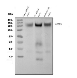 Invitrogen CaV1.1 Polyclonal Antibody 100 &mu;g | Buy Online | Invitrogen&trade; | Fisher Scientific