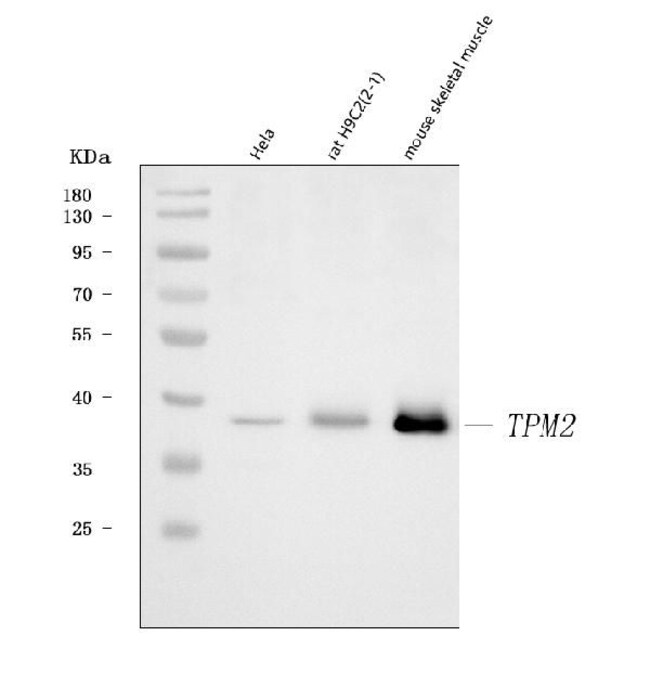 TPM2 Polyclonal Antibody, Invitrogen 100 μg; Unconjugated:Antibodies ...