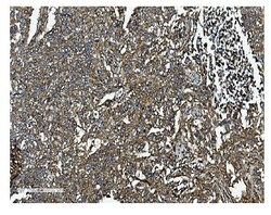 Invitrogen Clathrin Heavy Chain Polyclonal Antibody 100 μg; Unconjugated:Antibodies,