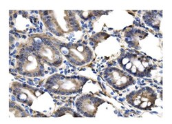 Invitrogen Clathrin Heavy Chain Polyclonal Antibody 100 μg; Unconjugated:Antibodies,