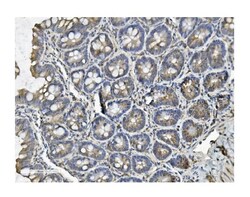 Invitrogen Clathrin Heavy Chain Polyclonal Antibody 100 μg; Unconjugated:Antibodies,