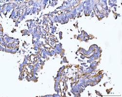 Invitrogen COL6A2 Polyclonal Antibody 100 &mu;g; Unconjugated:Antibodies,