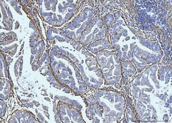 Invitrogen COL6A2 Polyclonal Antibody 100 &mu;g; Unconjugated:Antibodies,
