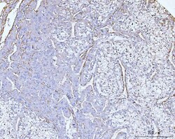 Invitrogen COL6A2 Polyclonal Antibody 100 &mu;g; Unconjugated:Antibodies,