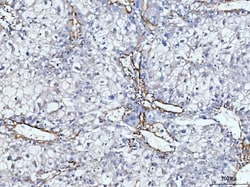 Invitrogen COL6A2 Polyclonal Antibody 100 &mu;g; Unconjugated:Antibodies,