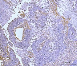 Invitrogen COL6A2 Polyclonal Antibody 100 &mu;g; Unconjugated:Antibodies,