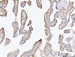 Invitrogen COL6A2 Polyclonal Antibody 100 &mu;g; Unconjugated:Antibodies,
