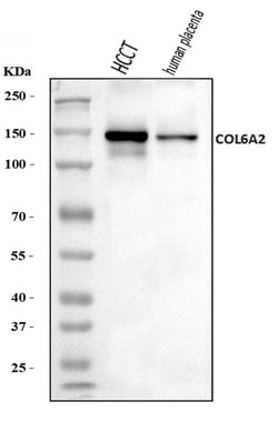 Invitrogen COL6A2 Polyclonal Antibody 100 &mu;g; Unconjugated:Antibodies,