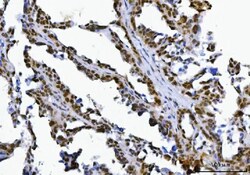 Invitrogen SPT5 Polyclonal Antibody 100 &mu;g | Buy Online | Invitrogen&trade; | Fisher Scientific