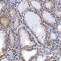 Invitrogen SPT5 Polyclonal Antibody 100 &mu;g | Buy Online | Invitrogen&trade; | Fisher Scientific