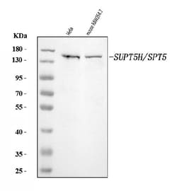 Invitrogen SPT5 Polyclonal Antibody 100 &mu;g | Buy Online | Invitrogen&trade; | Fisher Scientific
