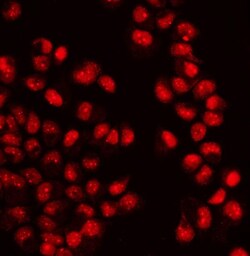 Invitrogen WAPL Polyclonal Antibody 100 μg; Unconjugated:Antibodies,