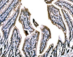 Invitrogen WAPL Polyclonal Antibody 100 μg; Unconjugated:Antibodies,