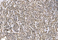 Invitrogen WAPL Polyclonal Antibody 100 μg; Unconjugated:Antibodies,