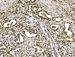 Invitrogen WAPL Polyclonal Antibody 100 μg; Unconjugated:Antibodies,