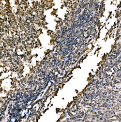 Invitrogen WAPL Polyclonal Antibody 100 μg; Unconjugated:Antibodies,