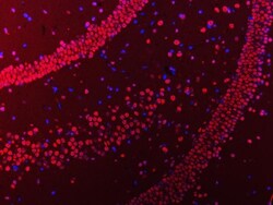 Invitrogen hnRNP U Polyclonal Antibody 100 &mu;g; Unconjugated:Antibodies,