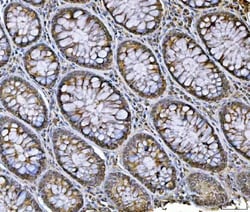 Invitrogen hnRNP U Polyclonal Antibody 100 &mu;g; Unconjugated:Antibodies,