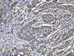 Invitrogen hnRNP U Polyclonal Antibody 100 &mu;g; Unconjugated:Antibodies,