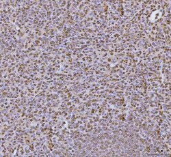 Invitrogen hnRNP U Polyclonal Antibody 100 &mu;g; Unconjugated:Antibodies,