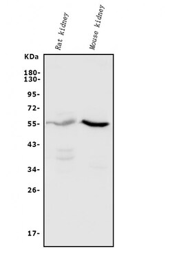Invitrogen CYP11B1/CYP11B2 Polyclonal Antibody 100 &mu;g; Unconjugated:Antibodies,