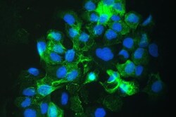 Invitrogen SLC34A2 Polyclonal Antibody 100 &mu;g; Unconjugated:Antibodies,