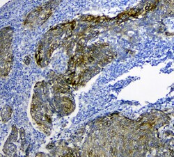 Invitrogen SLC34A2 Polyclonal Antibody 100 &mu;g; Unconjugated:Antibodies,