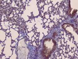 Invitrogen SLC34A2 Polyclonal Antibody 100 &mu;g; Unconjugated:Antibodies,