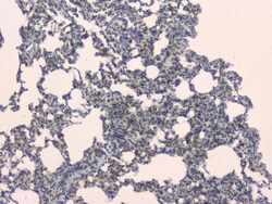 Invitrogen SLC34A2 Polyclonal Antibody 100 &mu;g; Unconjugated:Antibodies,