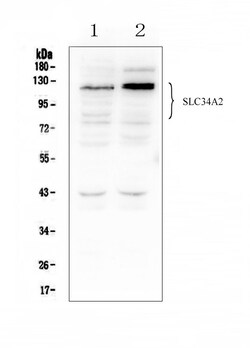Invitrogen SLC34A2 Polyclonal Antibody 100 &mu;g; Unconjugated:Antibodies,