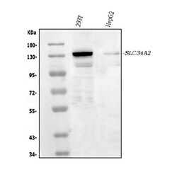 Invitrogen SLC34A2 Polyclonal Antibody 100 &mu;g; Unconjugated:Antibodies,