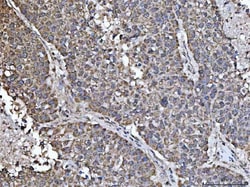 Invitrogen NDUFS5 Polyclonal Antibody 100 μg; Unconjugated:Antibodies,