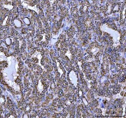 Invitrogen NDUFS5 Polyclonal Antibody 100 μg; Unconjugated:Antibodies,