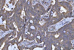 Invitrogen NDUFS5 Polyclonal Antibody 100 μg; Unconjugated:Antibodies,