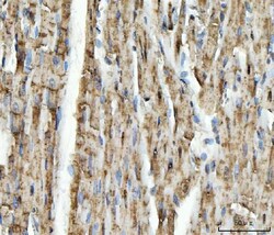 Invitrogen NDUFS5 Polyclonal Antibody 100 μg; Unconjugated:Antibodies,