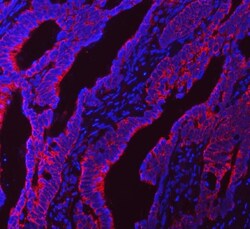 Invitrogen NDUFS5 Polyclonal Antibody 100 μg; Unconjugated:Antibodies,