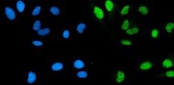 Invitrogen POLA1 Polyclonal Antibody 100 &mu;g; Unconjugated:Antibodies,