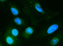 Invitrogen DIO1 Polyclonal Antibody 100 &mu;g; Unconjugated:Antibodies,