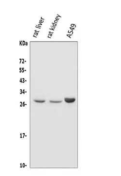 Invitrogen DIO1 Polyclonal Antibody 100 &mu;g; Unconjugated:Antibodies,