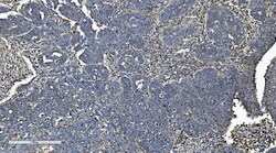 Invitrogen CMBL Polyclonal Antibody 100 &mu;g | Buy Online | Invitrogen&trade; | Fisher Scientific