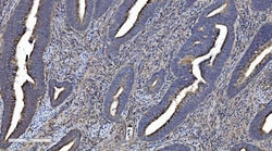 Invitrogen CMBL Polyclonal Antibody 100 &mu;g | Buy Online | Invitrogen&trade; | Fisher Scientific