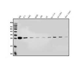 Invitrogen CMBL Polyclonal Antibody 100 &mu;g | Buy Online | Invitrogen&trade; | Fisher Scientific