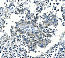 Invitrogen Kir6.1 (KCNJ8) Polyclonal Antibody 100 &mu;g | Buy Online | Invitrogen&trade; | Fisher Scientific