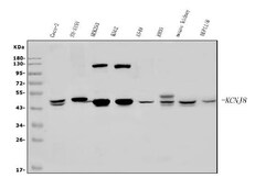 Invitrogen Kir6.1 (KCNJ8) Polyclonal Antibody 100 &mu;g | Buy Online | Invitrogen&trade; | Fisher Scientific