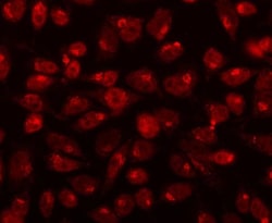 Invitrogen CDK13 Polyclonal Antibody 100 &mu;g; Unconjugated:Antibodies,