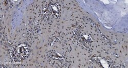 Invitrogen CDK13 Polyclonal Antibody 100 &mu;g; Unconjugated:Antibodies,