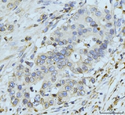 Invitrogen gp210 Polyclonal Antibody 100 &mu;g; Unconjugated:Antibodies,