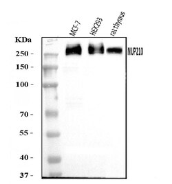 Invitrogen gp210 Polyclonal Antibody 100 &mu;g; Unconjugated:Antibodies,